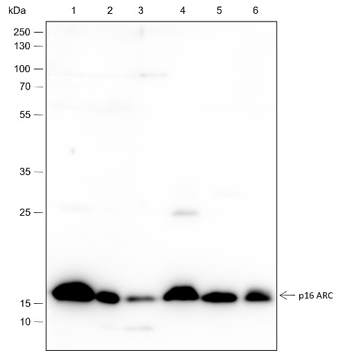 Recombinant ARPC5/p16 ARC Monoclonal Antibody (AN301616L)