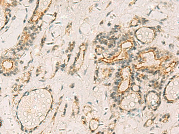 HORMAD2 Polyclonal Antibody (E-AB-53135)