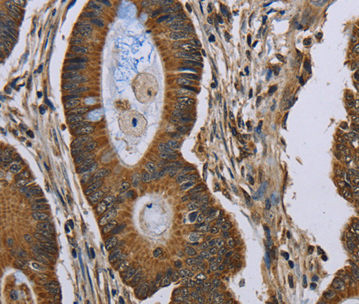 NEFH Polyclonal Antibody (E-AB-16639)