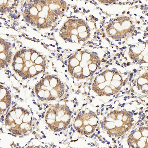 IL22RA1 Polyclonal Antibody (E-AB-70163)