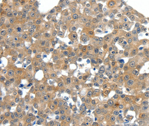 SCN11A Polyclonal Antibody (E-AB-12863)