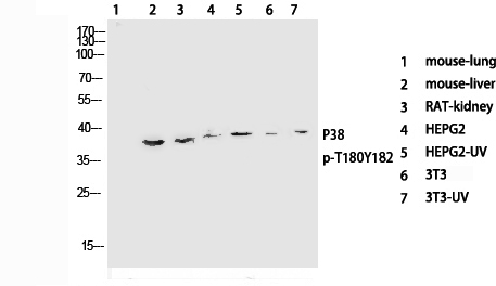 Phospho-P38 (Thr180/Tyr182) Polyclonal Antibody (E-AB-21027)