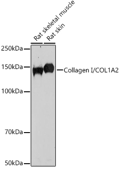 Collagen I/COL1A2 Polyclonal Antibody (E-AB-93159)
