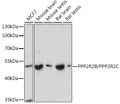 PPP2R2B/PPP2R2C Polyclonal Antibody (E-AB-92094)