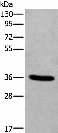 TNMD Polyclonal Antibody (E-AB-53343)