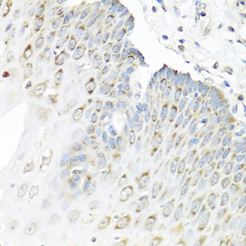 STAU1 Polyclonal Antibody (E-AB-62930)