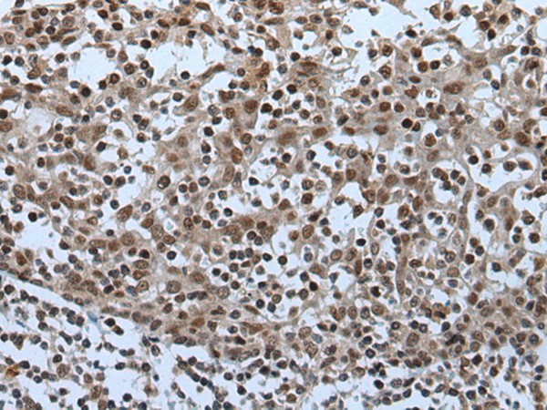 CELF5 Polyclonal Antibody (E-AB-19622)