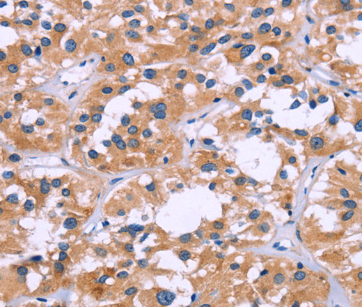 ZEB2 Polyclonal Antibody (E-AB-10589)