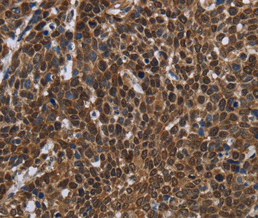 FASTKD2 Polyclonal Antibody (E-AB-11223)