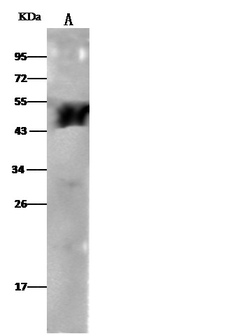 Recombinant ALDH3A1 Monoclonal Antibody (AN300160P)