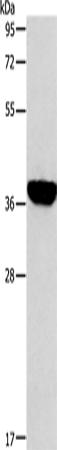 ALDOB Polyclonal Antibody (E-AB-12963)