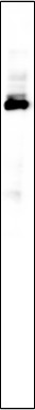 Recombinant BRAT1 Monoclonal Antibody (AN301225L)