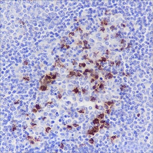 Recombinant PD1 Monoclonal Antibody (AN301420L)