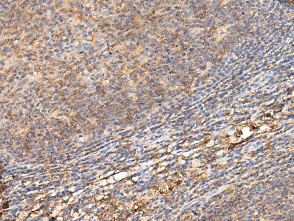 ADGRA1 Polyclonal Antibody (E-AB-19951)