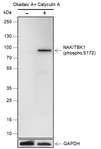 Recombinant Phospho-TBK1/NAK (Ser172) Monoclonal Antibody (AN302119L)