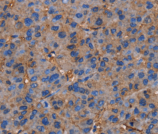 NRIP3 Polyclonal Antibody (E-AB-15261)