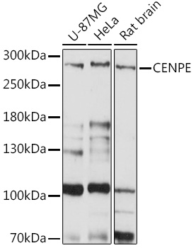 CENPE Polyclonal Antibody (E-AB-91089)
