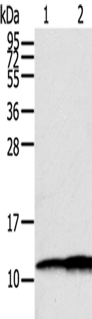 S100A11 Polyclonal Antibody (E-AB-15369)