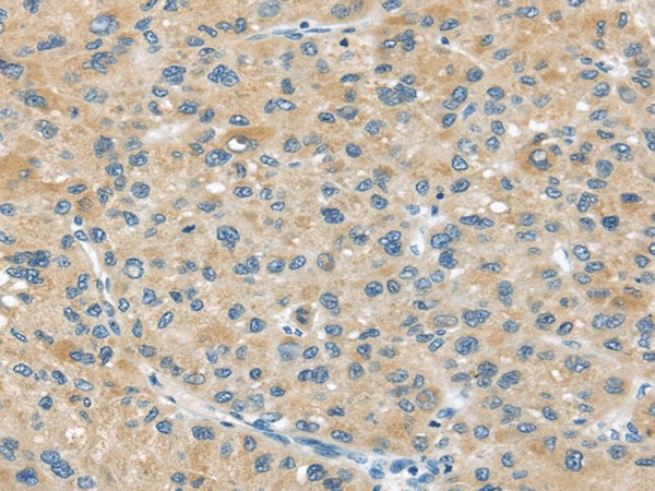 ABCC2 Polyclonal Antibody (E-AB-17352)