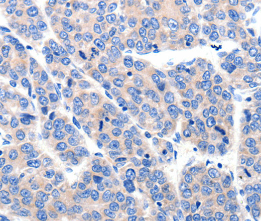 KCNH8 Polyclonal Antibody (E-AB-15707)