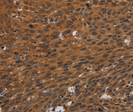 PNOC Polyclonal Antibody (E-AB-16651)