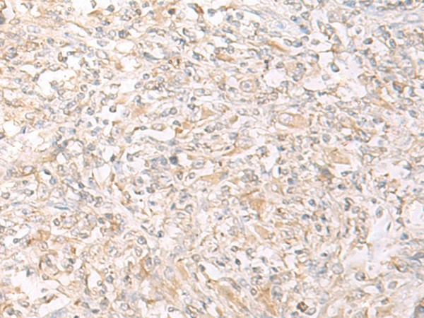 IL12B Polyclonal Antibody (E-AB-19816)