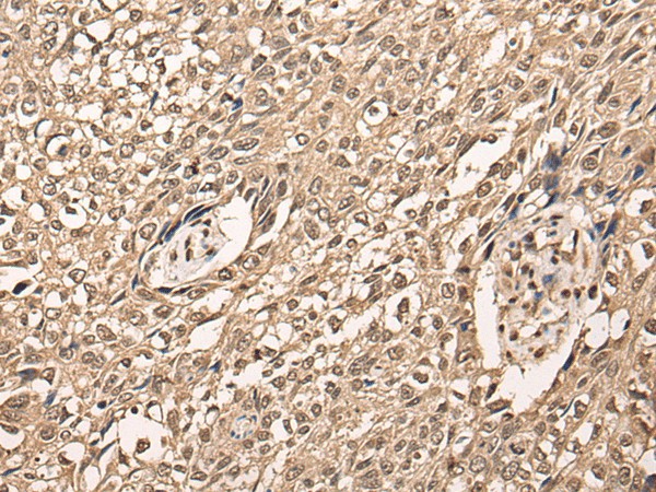 ATF7 Polyclonal Antibody (E-AB-52457)