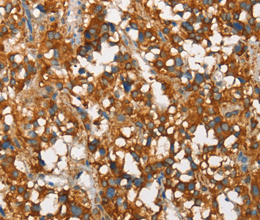 SNCA Polyclonal Antibody (E-AB-16253)