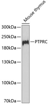 PTPRC Polyclonal Antibody (E-AB-60618)