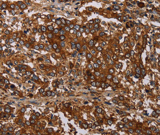 MAGEC2 Polyclonal Antibody (E-AB-16587)