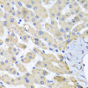 ABCB8 Polyclonal Antibody (E-AB-63057)