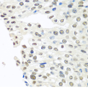 TARDBP Polyclonal Antibody (E-AB-64616)