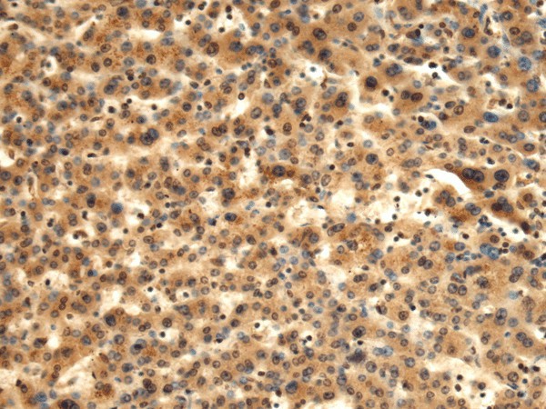 TMOD1 Polyclonal Antibody (E-AB-19254)