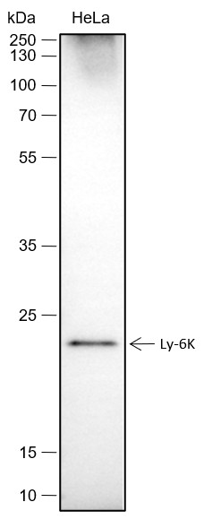 Recombinant Ly-6K Monoclonal Antibody (AN301716L)