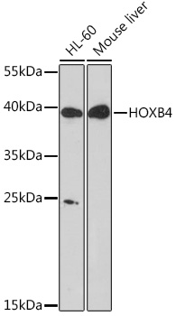 HOXB4 Polyclonal Antibody (E-AB-91644)