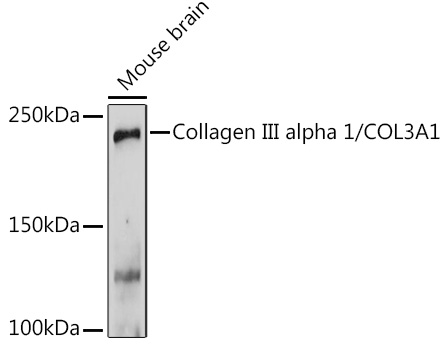COL3A1 Polyclonal Antibody (E-AB-62685)