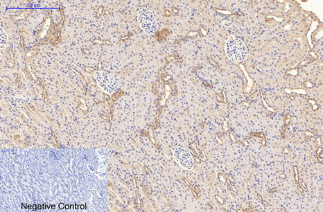 CD21 Monoclonal Antibody (E-AB-22023)