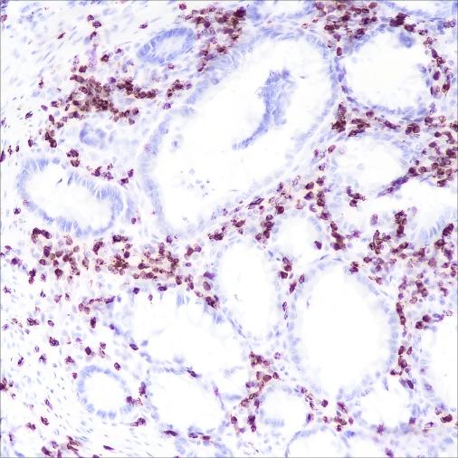 Recombinant CD2 Monoclonal Antibody (AN301469L)