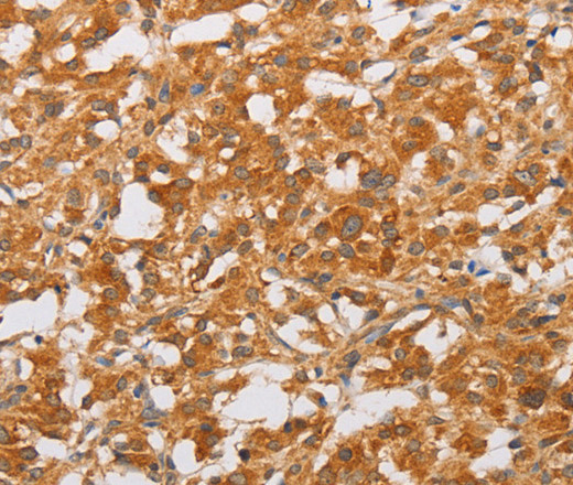 OLR1 Polyclonal Antibody (E-AB-10934)