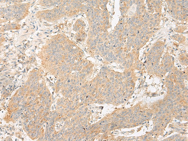 GP6 Polyclonal Antibody (E-AB-19916)