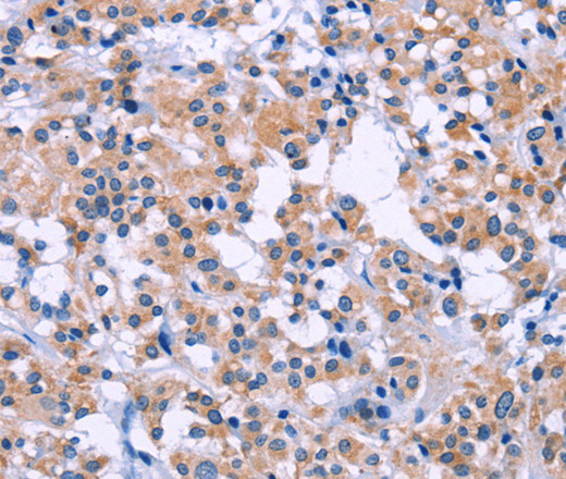 DUSP22 Polyclonal Antibody (E-AB-14065)