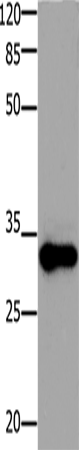 ADO Polyclonal Antibody (E-AB-15460)