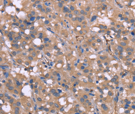 HP Polyclonal Antibody (E-AB-13303)