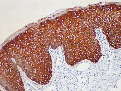 CK5/6 Monoclonal Antibody (ELAB6040-M)