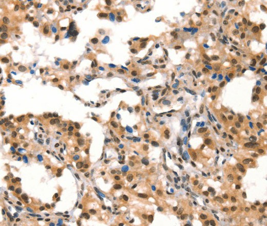 CUL4B Polyclonal Antibody (E-AB-16368)