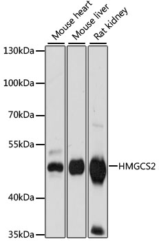 HMGCS2 Polyclonal Antibody (E-AB-64961)