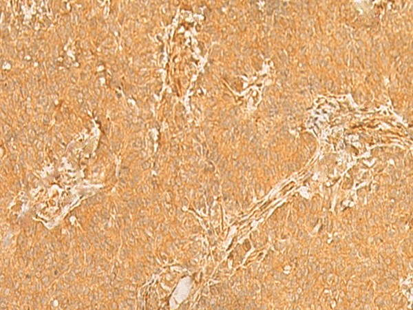 KRT76 Polyclonal Antibody (E-AB-18086)