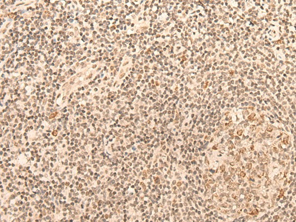CCNE1 Polyclonal Antibody (E-AB-19281)