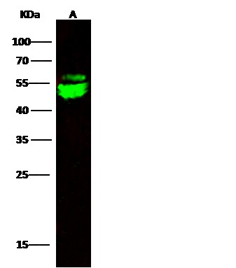 Recombinant CNDP2 Monoclonal Antibody (AN300496P)