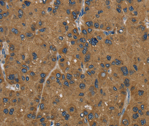 HSD17B2 Polyclonal Antibody (E-AB-15106)